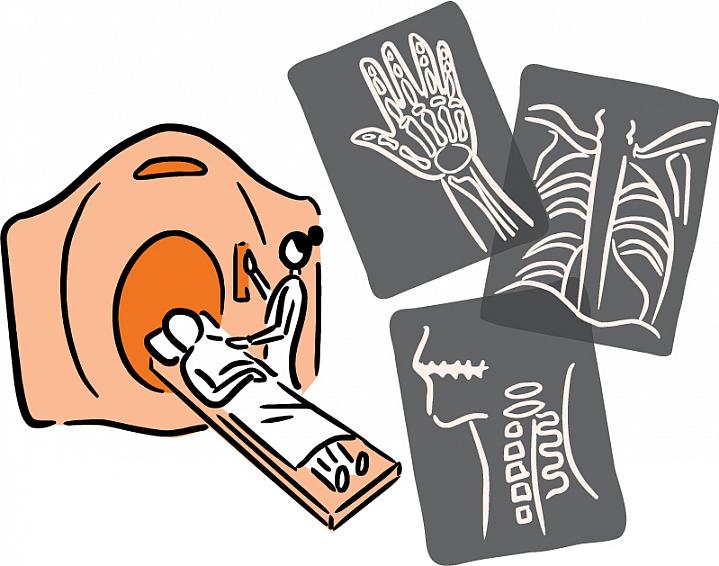 Illustration of 3 X-ray images and a patient entering a CT scanner.