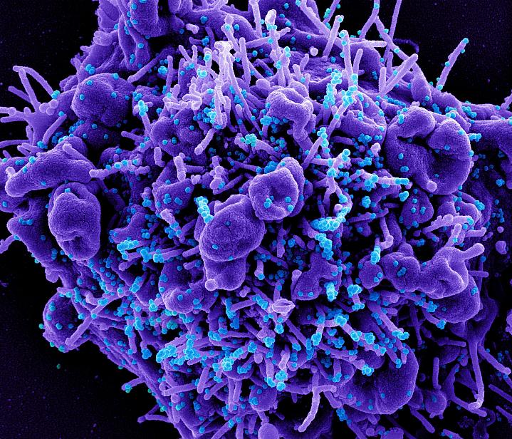 Image of the novel coronavirus, SARS-CoV-2 Image of the novel coronavirus, SARS-CoV-2